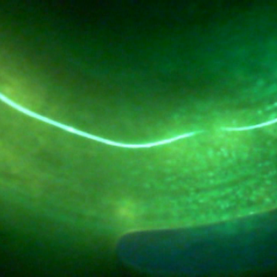 A severed nerve cell - microscopic roundworm species C. elegans can mend severed nerve cells through a process called axonal fusion.